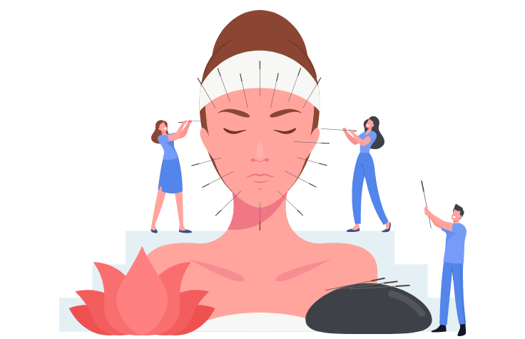 illustration acupuncture